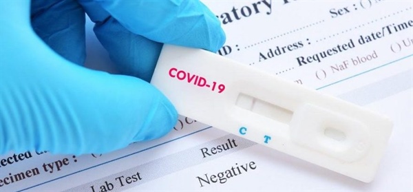 Sağlık Bakanlığı haftalık Covid-19 verilerini açıkladı… 2 kişi hayatını kaybetti, 309 pozitif vakaya rastlandı
