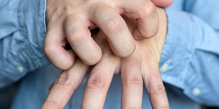 KTTB uyuz konusunda bilgilendirdi