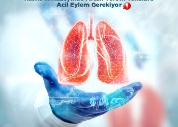 “ARTAN VEREM VAKALAR İÇİN ACİL EYLEM PLANI HAZIRLANMALI”