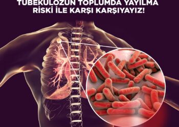 “VEREM TARAMASINDA PPD TESTİ ŞART”