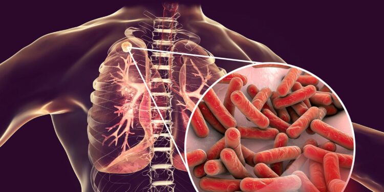 “VEREM TARAMASINDA PPD TESTİ ŞART”