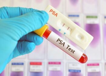 PAZAR YERLERİNDE PROSTAT KANSERİYLE İLGİLİ ÜCRETSİZ TARAMA TESTİ YAPILACAK